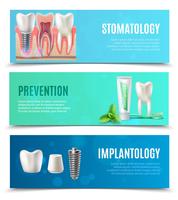 Implantaten 3 Horizontale Banners Set vector