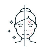 vrouw met acne en schoon gezicht huid lijn icoon. vrouwelijke huidverzorging voor het reinigen van gezicht en probleemhuid overzicht icoon. meisje voor en na huidbehandeling lineair pictogram. geïsoleerde vectorillustratie. vector