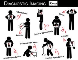 Diagnostische beeldvorming &amp; Multiple Disease stick man vector (longtuberculose, artritis, cervicale spondylose, lumbale spondylose en spondylolisthesis, scoliose, artrose knie, beroerte)