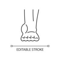 enkel ontsteking lineaire pictogram. gezwollen voet en enkel. ontwikkeling van artrose. tendinitis. dunne lijn aanpasbare illustratie. contour symbool. vector geïsoleerde overzichtstekening. bewerkbare streek