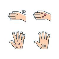 artritis in handen rgb kleur iconen set. polsen reuma. vingers misvorming. reumatoïde knobbeltjes. artrose in de duim. geïsoleerde vectorillustraties. verzameling eenvoudige gevulde lijntekeningen vector