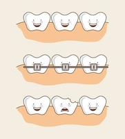 Set cartoon tandheelkundige tanden beelden vector