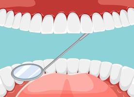 instrumenten die de tanden van de patiënt in de menselijke mond onderzoeken; vector