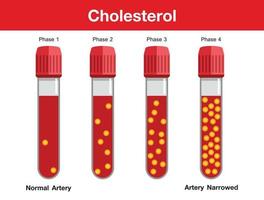 cholesterol in slagader, gezondheidsrisico, vectorontwerp vector