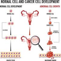 diagram dat normale en kankercellen bij de mens toont vector