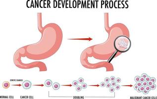 diagram dat normale en kankercellen bij de mens toont vector