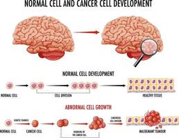 diagram met normale cel en kankercel vector