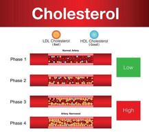 cholesterol in slagader, gezondheidsrisico, vectorontwerp vector