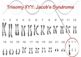 trisomie xyy jacobs syndroom vector