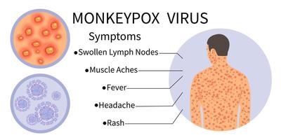 Monkeypox-virusbanner voor symptoombewustzijn. apenpokkenvirus symptomen infographic. menselijk lichaam met uitslag. symptomen van de ziekte - gezwollen lymfeklieren, spierpijn, koorts, hoofdpijn, uitslag.vector. vector