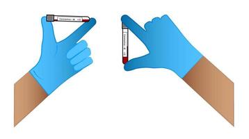 artsen leveren een handschoen in die reageerbuisjes vasthoudt met coronavirustests. positief en negatief resultaat. geïsoleerde vector op witte achtergrond