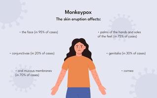 informatieposter symptoom van apenpokken vector