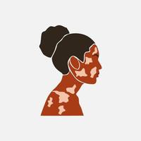 abstract silhouet van schoonheid zwarte huid vrouw met witte pigmentatie. ondersteuning van het bewustzijn over chronische huidaandoening. wereld vitiligo dag. diversiteit tolerantie. mode papier gesneden illustratie vector