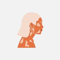 abstract silhouet van schoonheid wit haar vrouw met witte pigmentatie. ondersteuning van het bewustzijn over chronische huidaandoening. wereld vitiligo dag. diversiteit tolerantie. mode papier gesneden illustratie vector