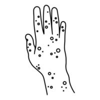 pijnlijke uitslag op het vectorpictogram van de rechterhand. handpalm met zweren, blaren, zweren op de huid. symptoom van een virale, allergische ziekte. dermatitis, apenpokken, psoriasis, eczeem. overzicht geïsoleerd op wit vector