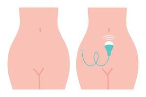 gynaecologische controle. medisch EXAMEN. gynaecologie echografie. vector