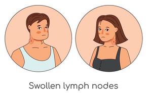 gezwollen lymfeklieren man en vrouw pictogrammen. griepvirus koude cartoon medische infographic vectorillustratie. vector