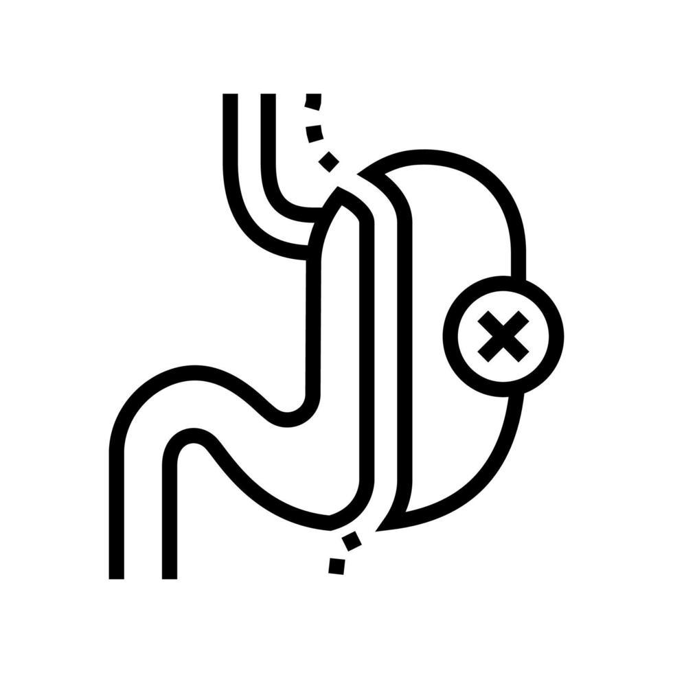 Hülsenresektion bariatrische Linie Symbol Vektor Illustration