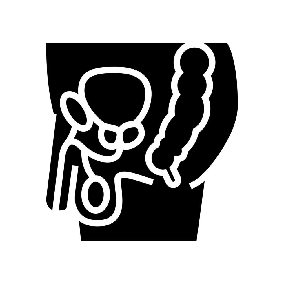 Patient mit Prostata-Glyphen-Symbol-Vektorillustration vektor