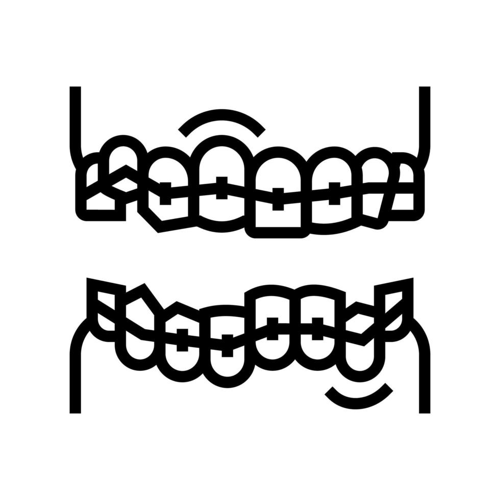 Korrektur Zahnspangen Symbol Leitung Vektor Illustration