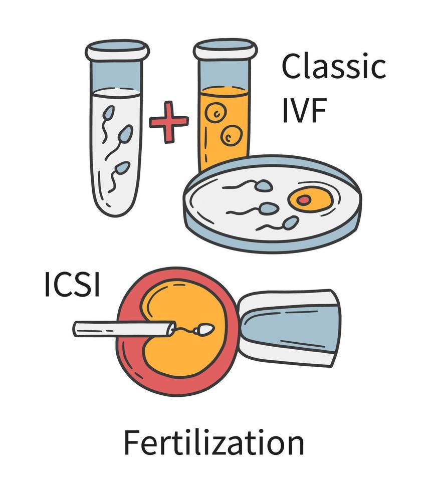 In-vitro-Fertilisation ivf und intrazytoplasmatische Spermieninjektion icsi vektor