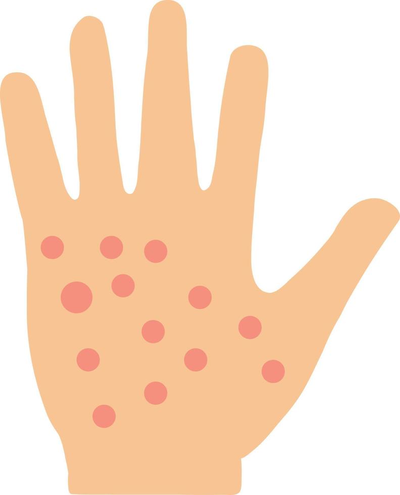 eksem hand hud ikon på vit bakgrund. allergisk reaktion symbol. irritation på hand tecken. platt stil. vektor