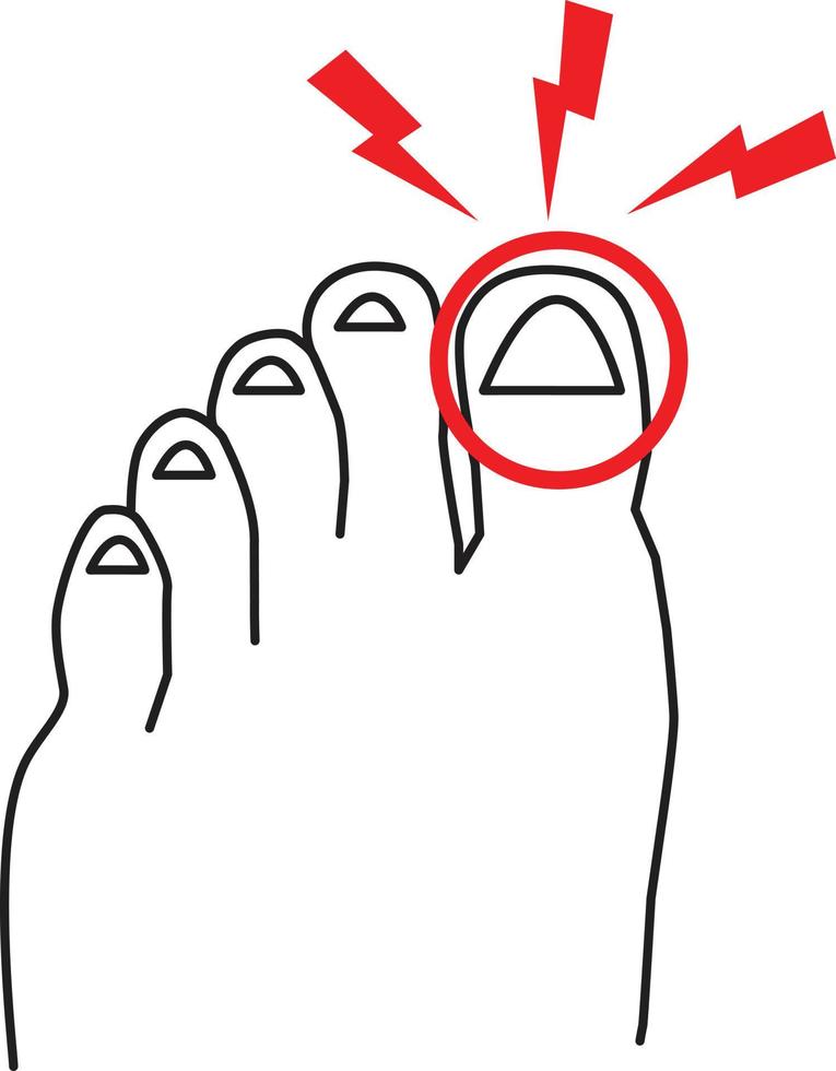 öm stor tå ikon på vit bakgrund. fot smärta tecken. ben med en tå skada symbol. platt stil. vektor