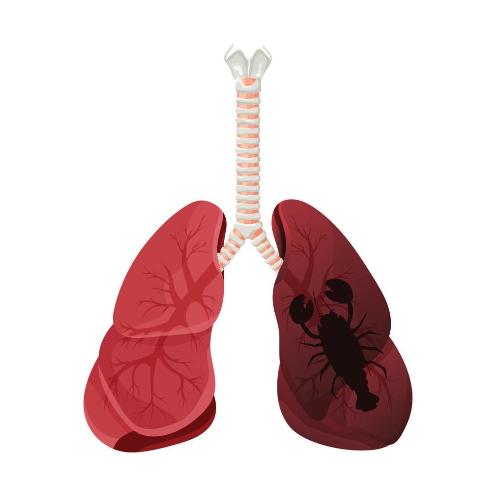 illustration av lungrökare, lungcancersjukdom. konceptet att sluta röka. vektor illustration.