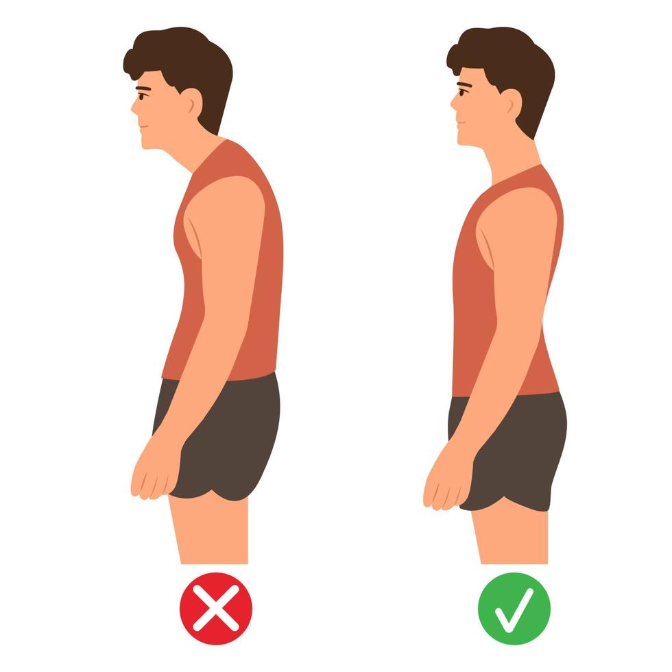korrekt och felaktig stående hållning.cervikal ryggmärgskurvatur. puckel. friska back.vector illustration på vit bakgrund. vektor