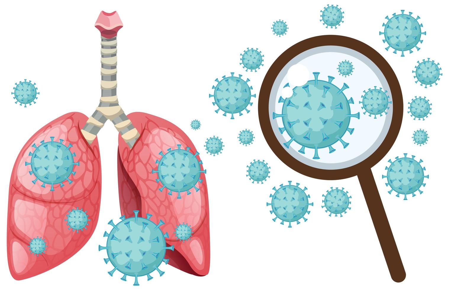 coronaviruscell i mänskliga lungor vektor