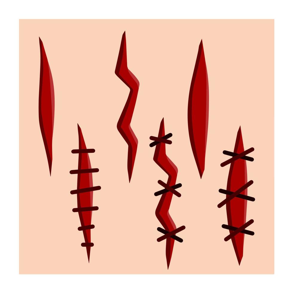 blodig sår. uppsättning av repor. stygn och medicinsk vård. mall för hud skada. en blödning skära. platt tecknad serie illustration vektor