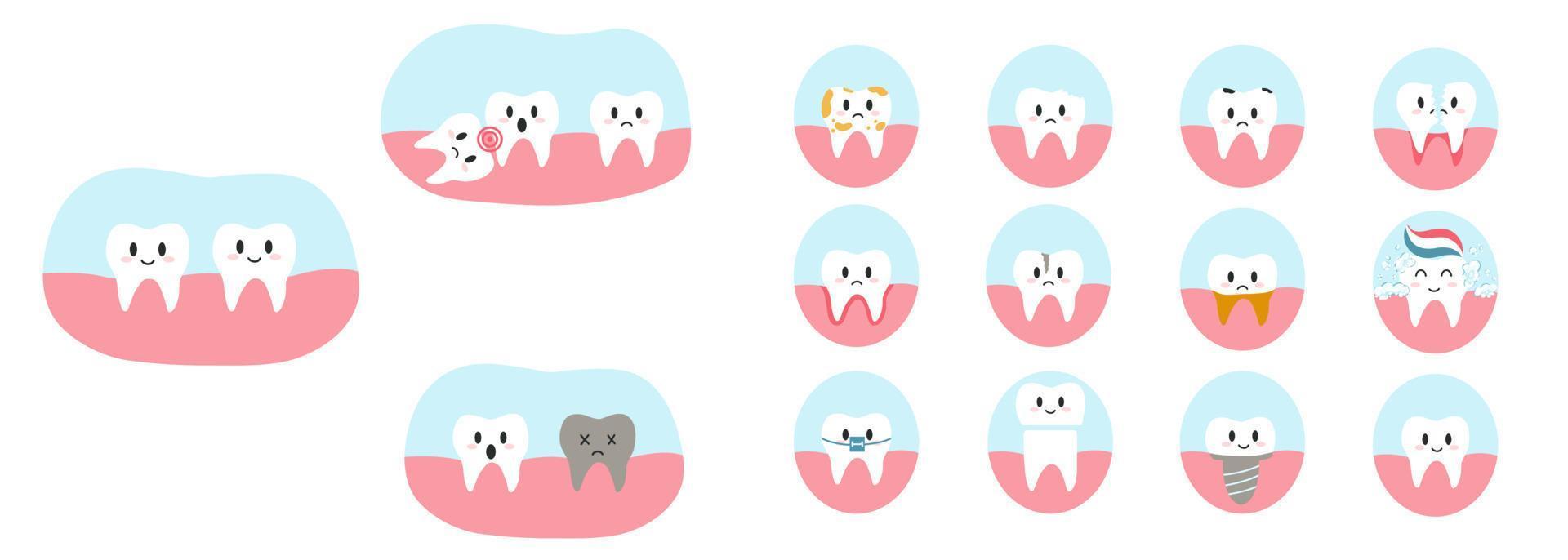 uppsättning av tänder tecken i tecknad serie platt stil. vektor illustration av olika dental sjukdomar och tand skick, som karies, spricka, dela, gingivit, implantera, visdom tand för broschyr, tandläkare klinik