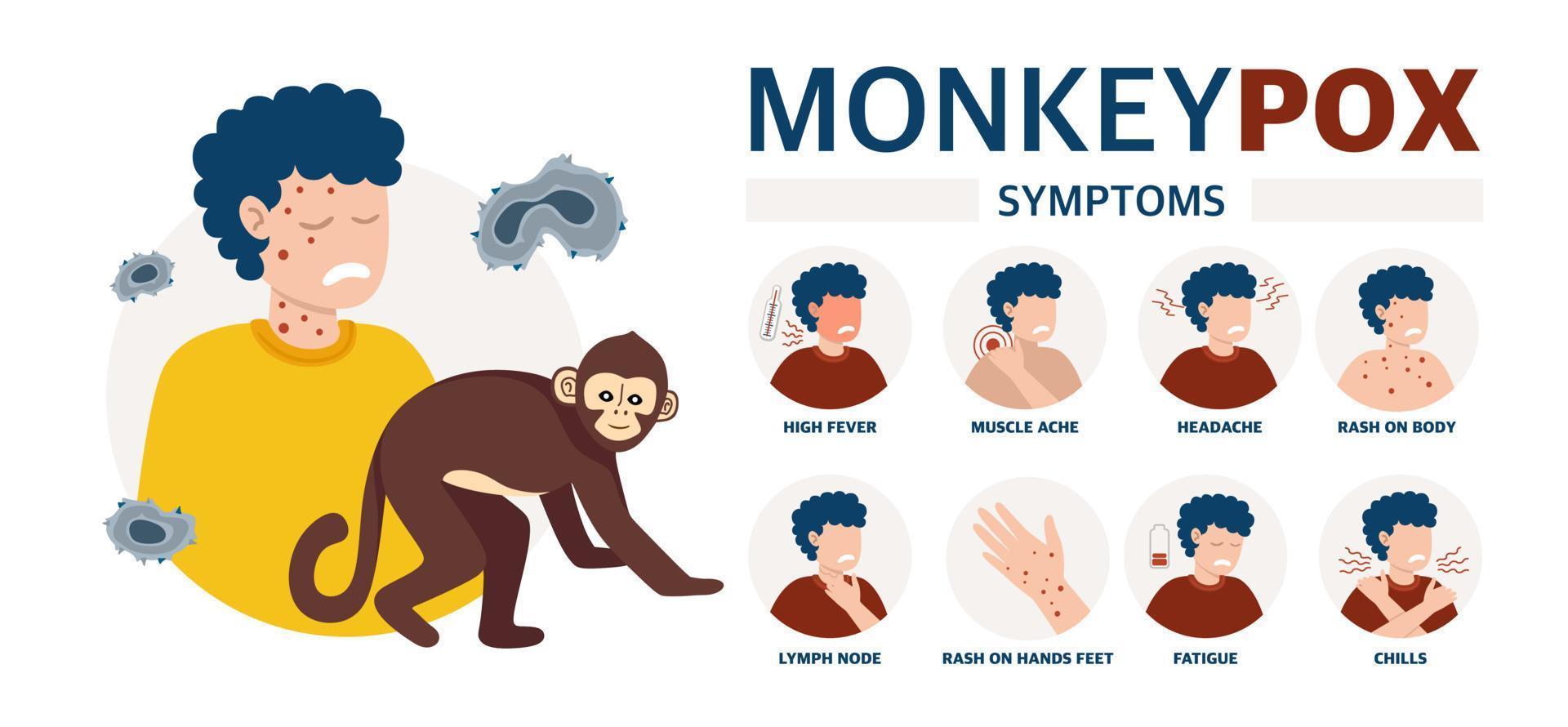 Affenpockenvirus-Poster zur Information über die Pandemie und die Ausbreitung der Krankheitsbilder einer Person und Symptome der Krankheitsvektorillustration vektor