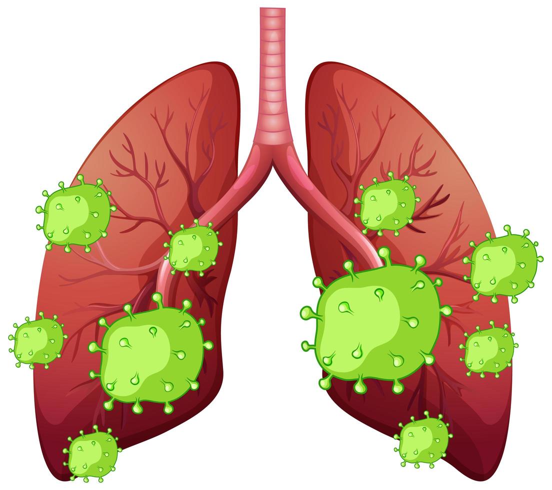 mänskliga lungor och coronavirusceller på vit bakgrund vektor