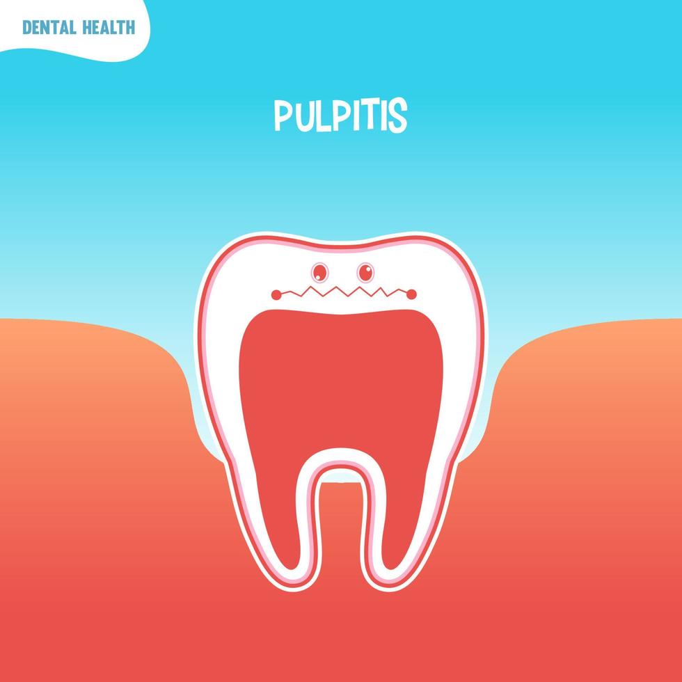 Cartoon schlechtes Zahnsymbol mit Pulpitis vektor