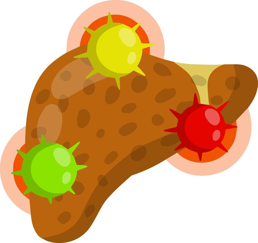 schlechte Leber. Angriffskeime und Leberzirrhose. Gesundheitsproblem vektor