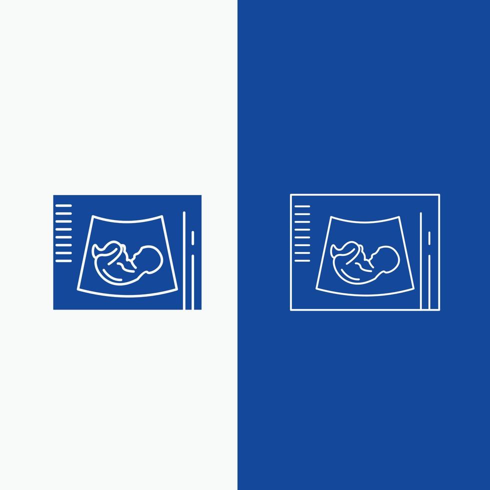 moderskap. graviditet. sonogram. bebis. ultraljud linje och glyf webb knapp i blå Färg vertikal baner för ui och ux. hemsida eller mobil Ansökan vektor