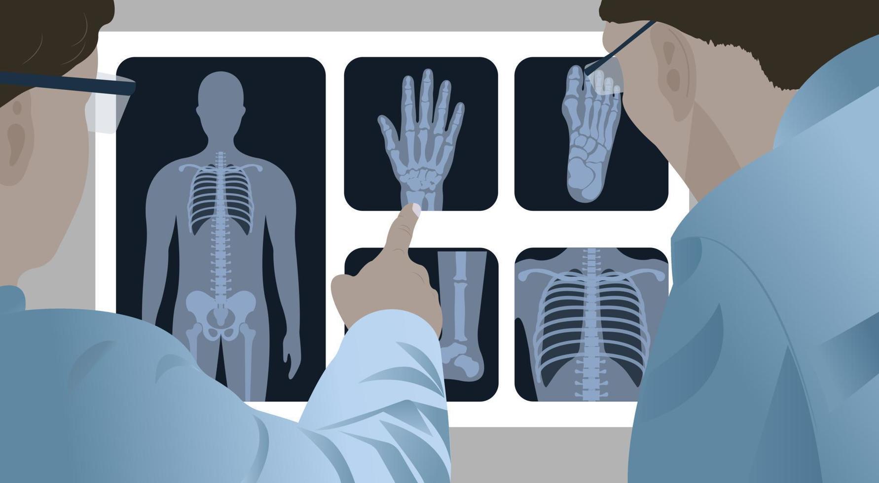 ärzte untersuchen eine röntgenaufnahme von brust, hände, füße des patienten in der röntgenabteilung des krankenhauses vektor