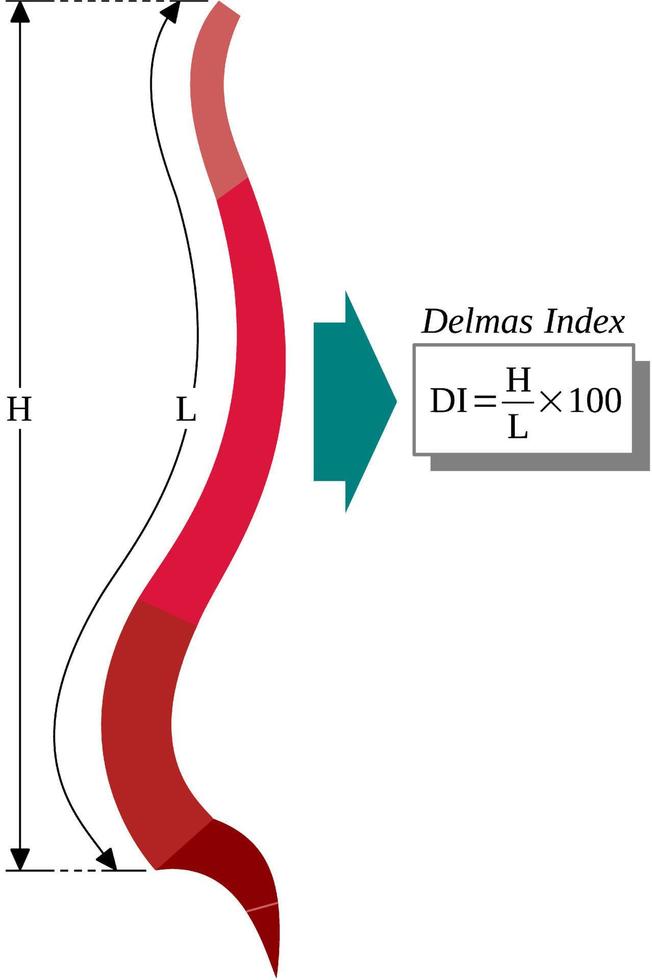 Delmas-Index oder Verhältnis zwischen Länge und Höhe der Wirbelsäule vektor