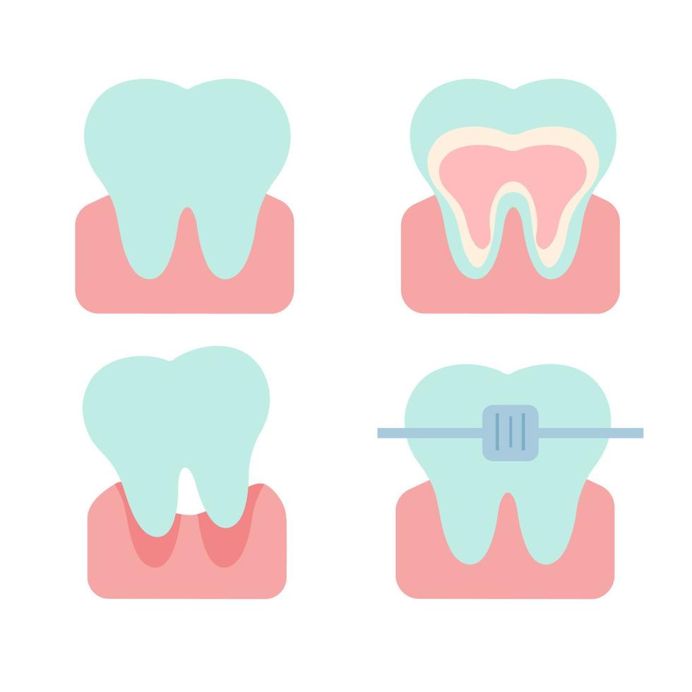vektorflache illustration von zähnen in verschiedenen zuständen. vektor