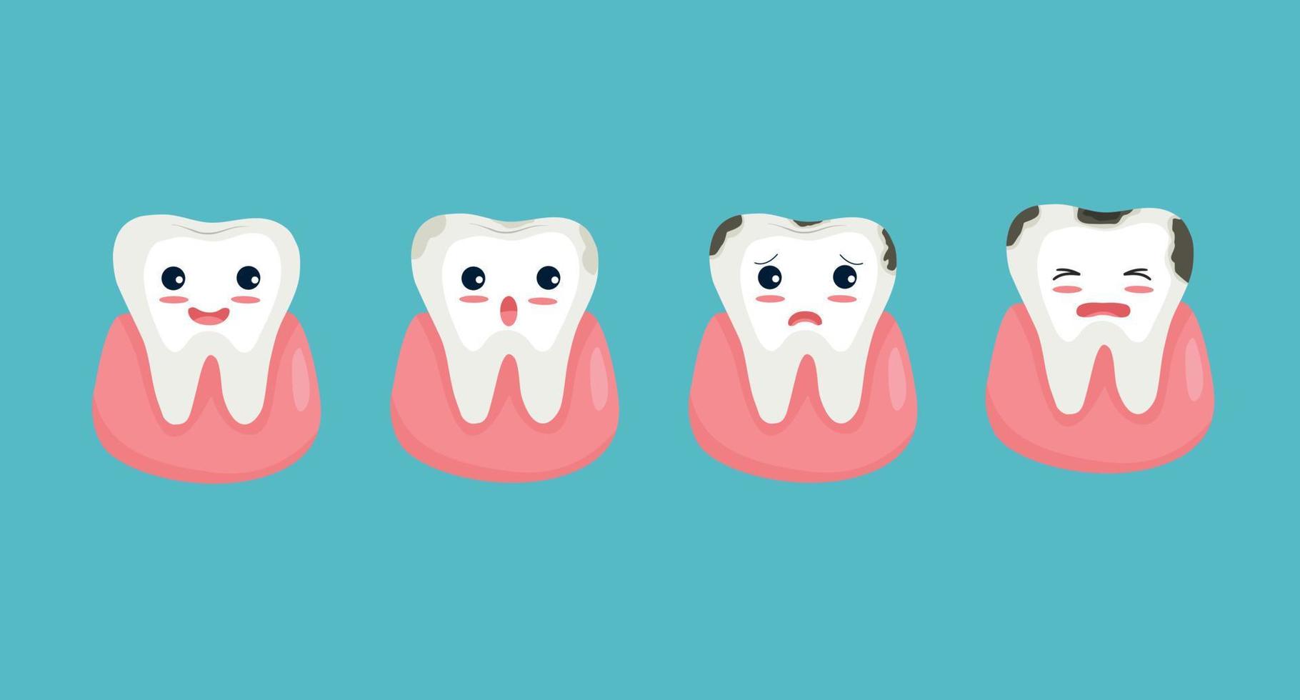 niedlicher zahncharakter, der stadien des zähneverfalls vom gesunden zahn bis zur zahnplaquekaries zeigt vektor