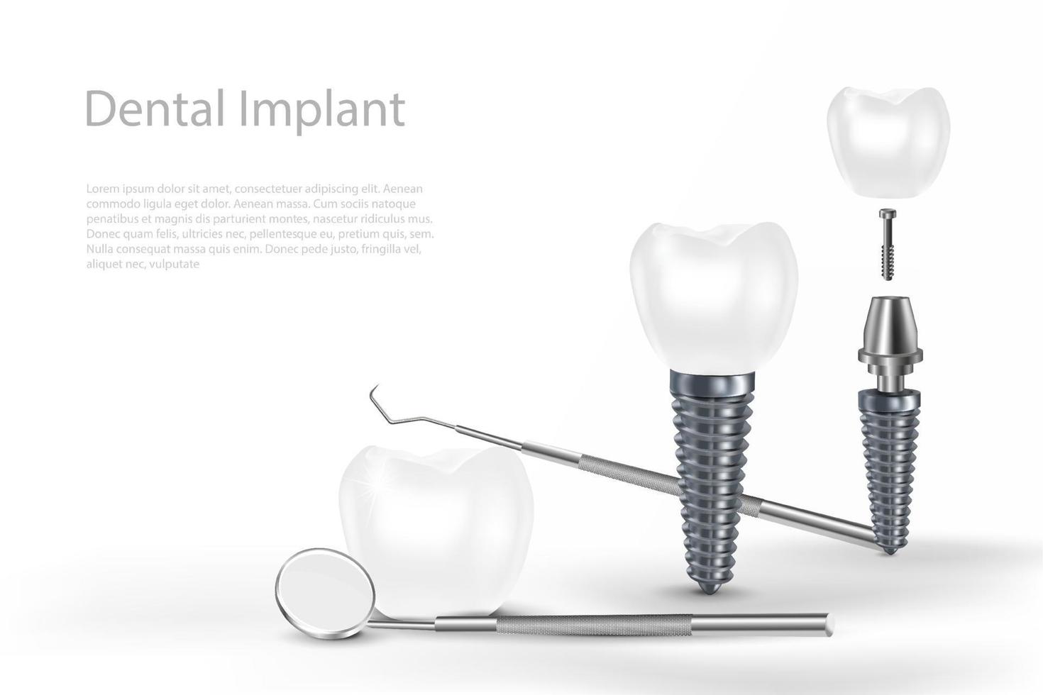 3d dental implantat kirurgi begrepp med verktyg. vektor