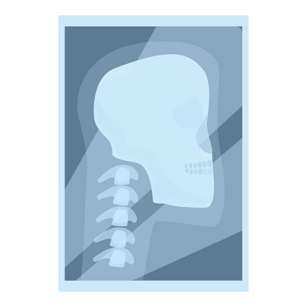 Röntgen-Schulter-Scan-Symbol Cartoon-Vektor. medizinische Maschine vektor
