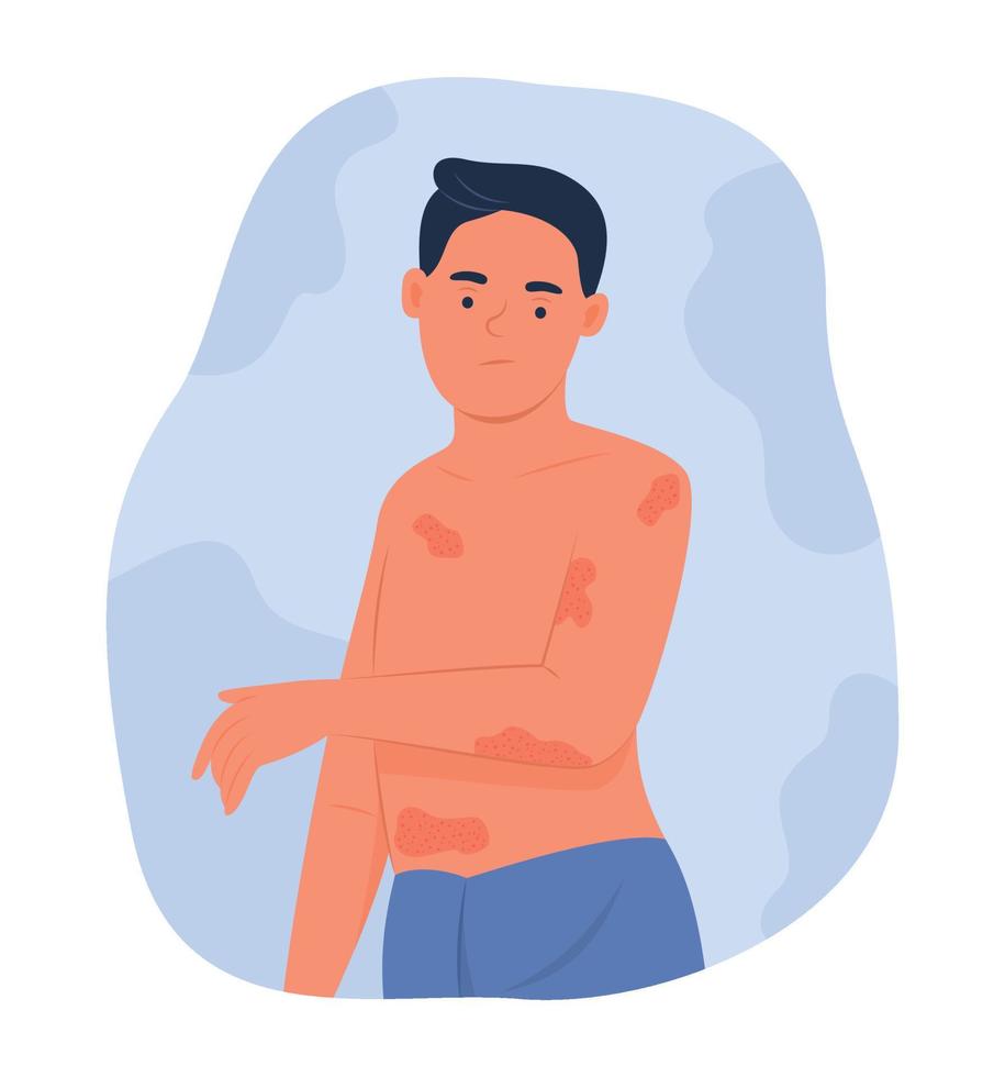 Mann mit atopischer Dermatitis oder Ekzem am Körper vektor