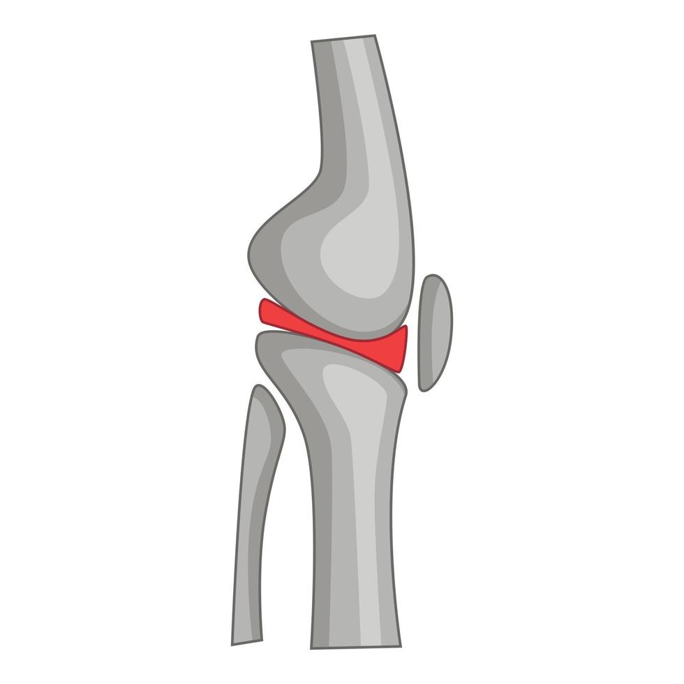 Ikone der totalen Knieersatzoperation, Cartoon-Stil vektor