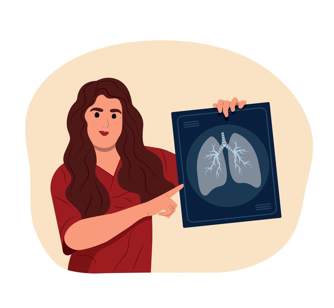leende kvinna läkare innehar röntgen av lungor i hand till förhindra astma. värld astma dag.bronkial astma. allergi, astmatiker. inandning läkemedel. bronkial astma. vektor