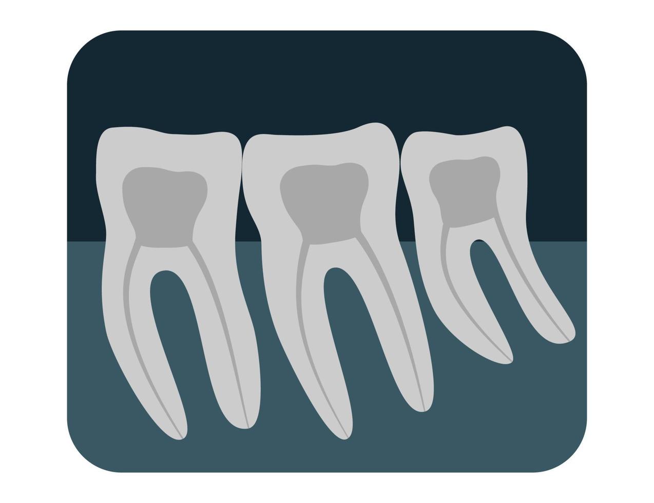 röntgen av mänsklig tänder. tre friska molarer på ett röntgen. vektor illustration.