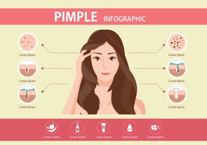 Pimple Infografisch vektor