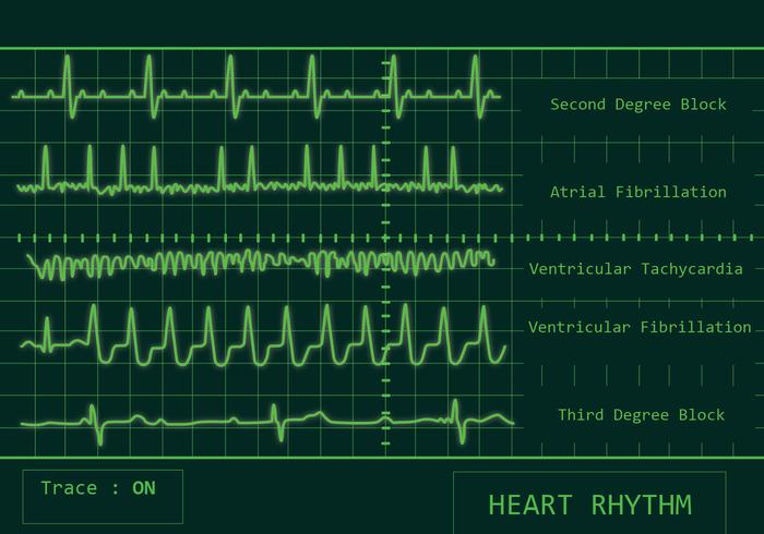 Herz-Rhythmus-Vektor-Pack vektor