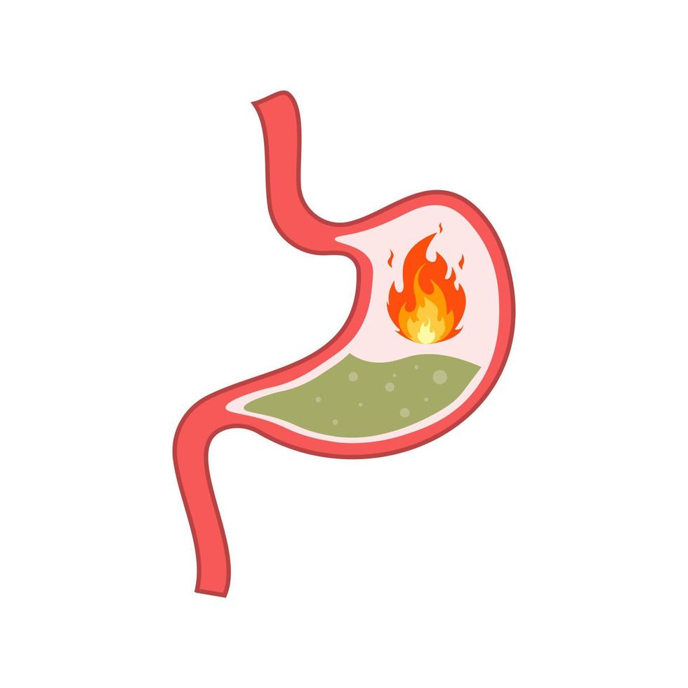 från syra återflöde eller halsbränna och gastrit. dålig matsmältning och mage värk problem begrepp. isolerat vektor illustration